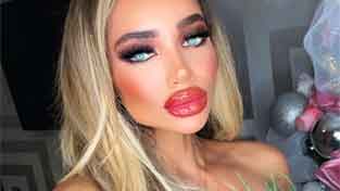 Lip injections