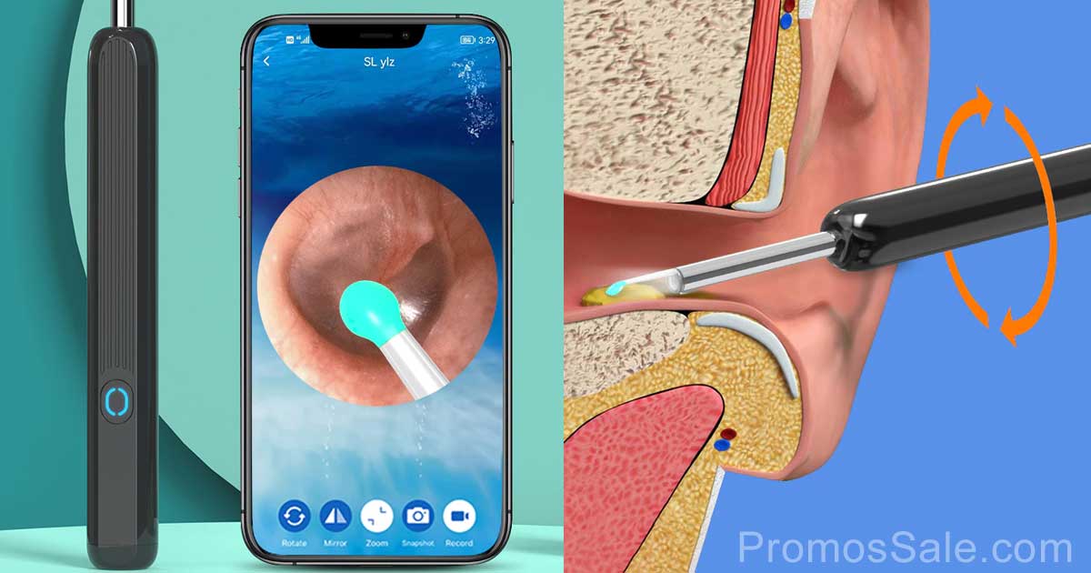 Smart Ear Cleaner: The Intelligent Solution for Ear Cleaning